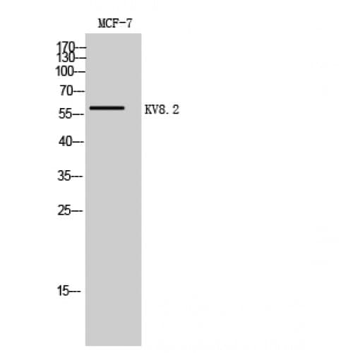 KCNV2 / Kv11.1 Antibody (160-240 aa, Internal)