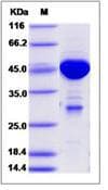 Human MOB1B / MOBKL1A Protein (Recombinant GST, N-terminus)