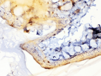PPL / Periplakin Antibody