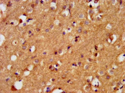 BAIAP3 Antibody