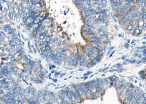 SYT1 / Synaptotagmin Antibody (phospho-Ser309)