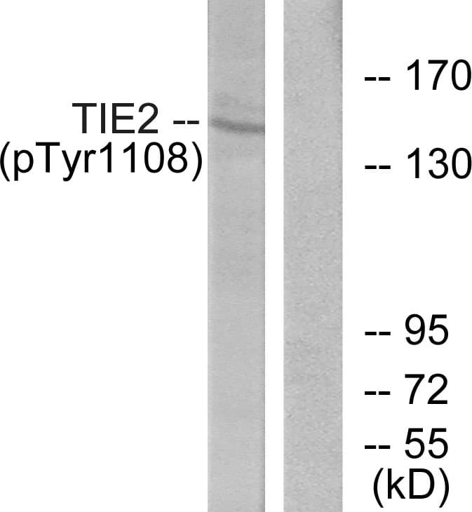 TEK / TIE2 Antibody (phospho-Tyr1108)