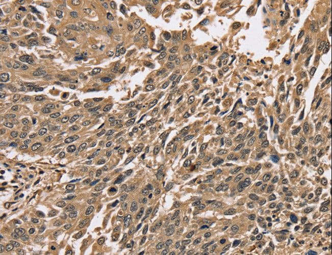 PPP1CC / PP1 Gamma Antibody