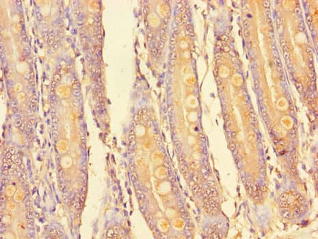 PIM2 / Pim-2 Antibody