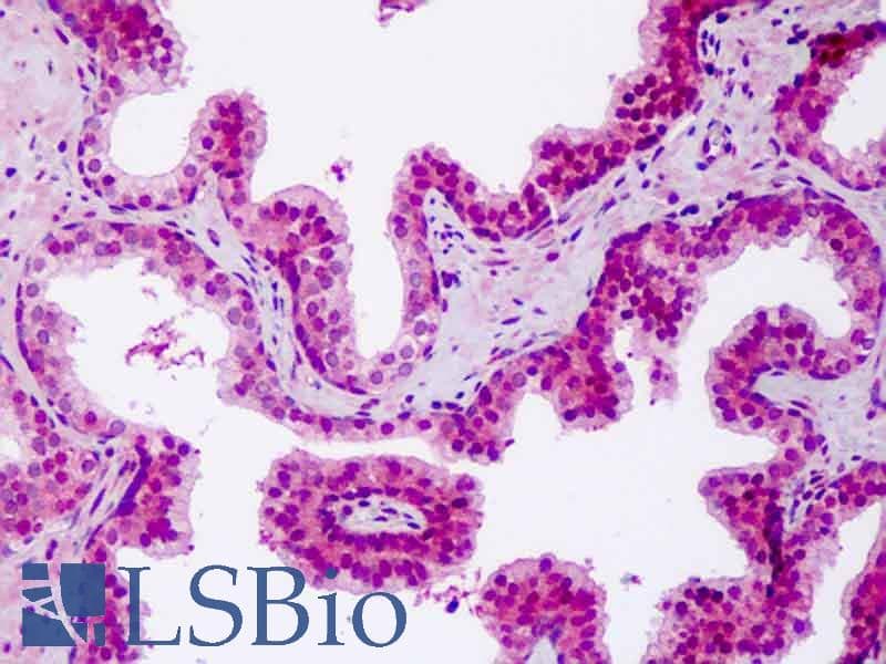IHC-plus™ Polyclonal Rabbit anti-Human NOD1 Antibody (aa923-951, IHC, WB)
