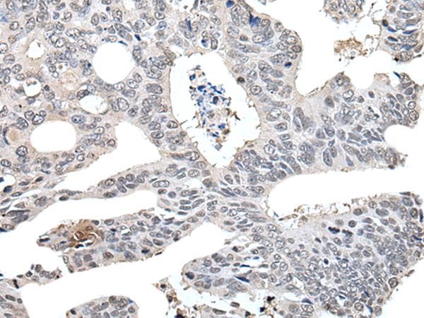 Polyclonal Rabbit anti-Human TCEB2 / Elongin B Antibody (IHC)