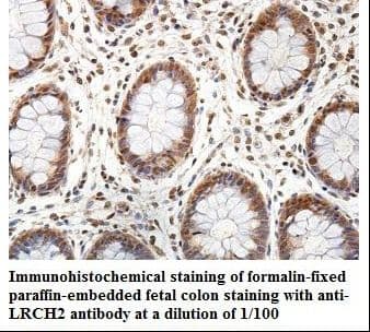 LRCH2 Antibody (aa554-742)