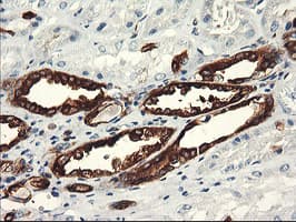 PFKP Antibody (clone OTI1F2)