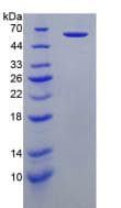 Human PRF1 / Perforin Protein (Recombinant His-GST, N-terminus)