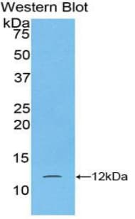 S100A5 Antibody (aa1-92, clone C8, PE)