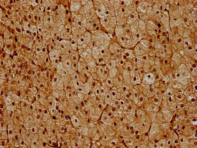 PSMC6 Antibody
