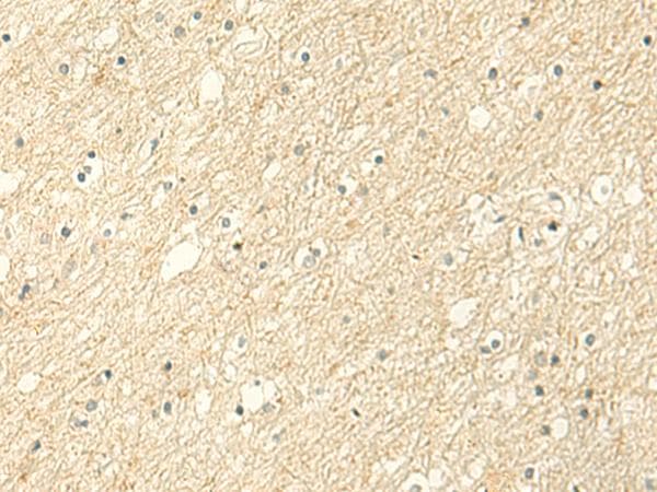 Polyclonal Rabbit anti-Human ALPK1 Antibody (IHC)