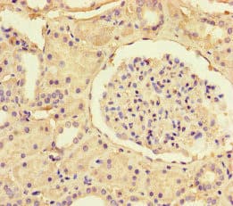 Polyclonal Rabbit anti-Human SSTR2 Antibody (IHC, IF, WB)