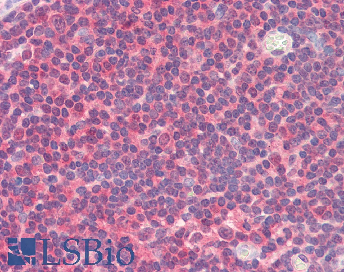 IHC-plus™ UBE2L6 Antibody (aa1-152, clone K1H3)