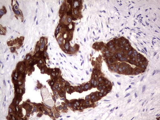 CD30 Antibody (aa19-379, clone OTI2G7)