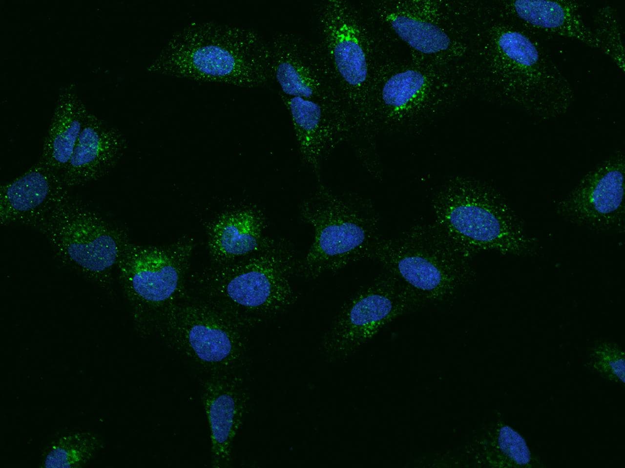 Polyclonal Rabbit anti-Human TMEM192 Antibody (IHC, IF, WB)