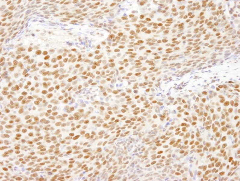 HNRNPUL1 Antibody (aa50-100)