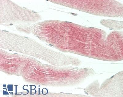 IHC-plus™ KPI-2 / LMTK2 Antibody (aa636-685)
