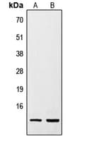 RETN / Resistin Antibody (Internal)