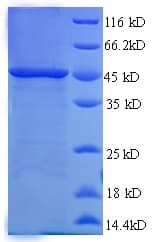 Human SMARCB1 / INI1 Protein (Recombinant 6His, N-terminus)
