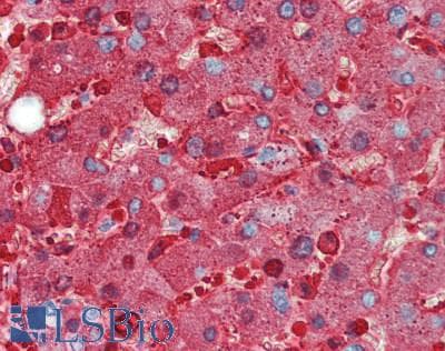 Ferritin Antibody