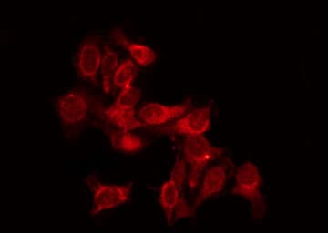 THRA / THR Alpha Antibody