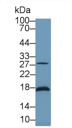 Latexin / MUM Antibody (aa1-222)