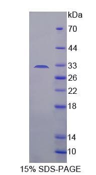 Human ADAM33 Protein (Recombinant His-S)
