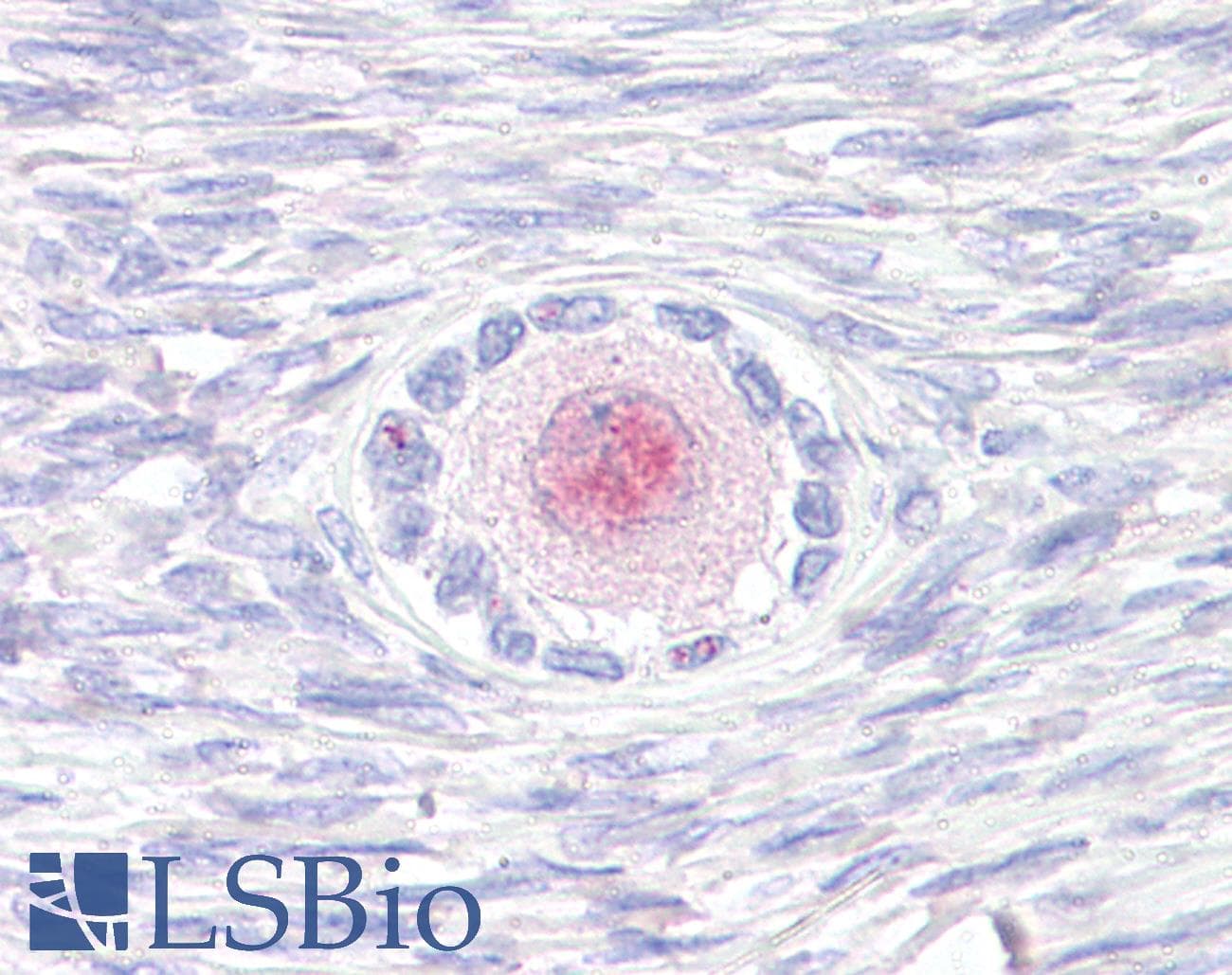 IHC-plus™ Polyclonal Rabbit anti-Human TM9SF4 Antibody (Internal, IHC)