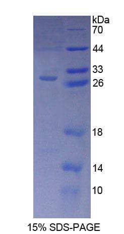 Human ARA9 / AIP Protein (Recombinant His-T7)