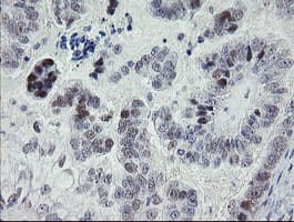 TLE1 / TLE 1 Antibody (aa180-460, clone OTI2D8)