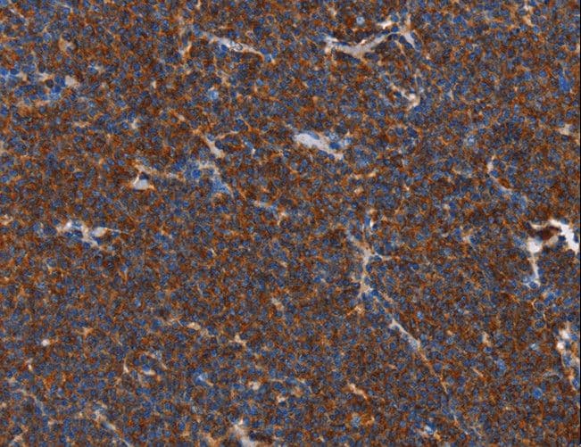 Polyclonal Rabbit anti-Human PLK3 Antibody (IHC)