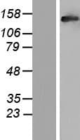 RAB3GAP2 / p150 Protein (Over-Expression Lysate Myc-DDK (Flag))