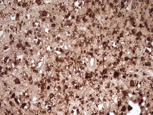 FARSB Antibody (clone OTI4B3)