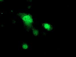 PRKAR1B Antibody (clone OTI1B4)