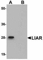 IHC-plus™ ANKRD54 / LIAR Antibody