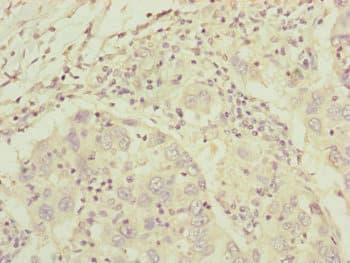 Complement C8A Antibody (aa310-460)