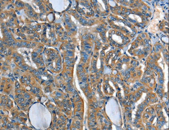 Polyclonal Rabbit anti-Human ADCY4 / Adenylate Cyclase 4 Antibody (IHC)