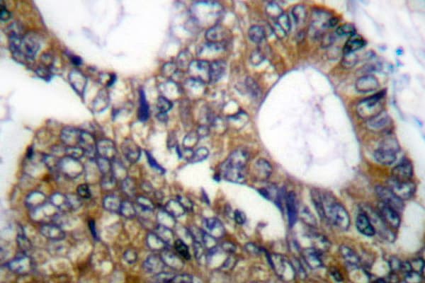 HSPH1 / HSP105 Antibody (Pro819)