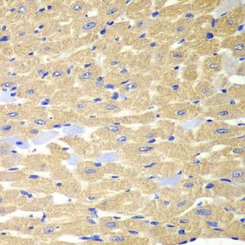 Polyclonal Rabbit anti-Human RPH3A / Rabphilin 3A Antibody (IHC, WB)