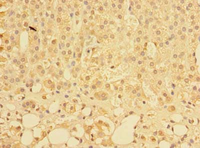 PLEKHS1 / C10orf81 Antibody
