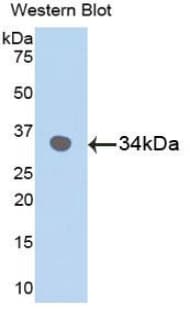 MAPK9 / JNK2 Antibody (aa130-387)