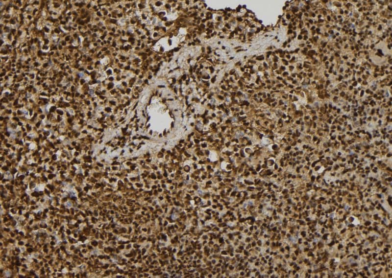 EIF3A Antibody