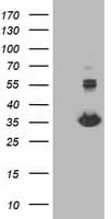 MGLL / Monoacylglycerol Lipase Antibody (clone OTI1C6)