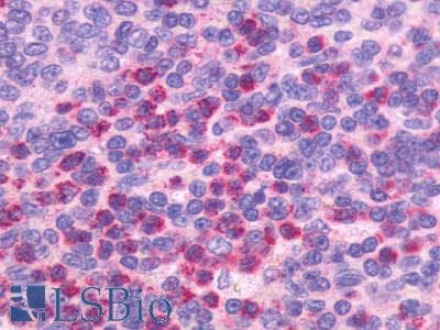 IHC-plus™ Polyclonal Rabbit anti-Human CXCR5 Antibody (C-Terminus, IHC)
