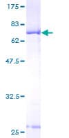 Human BCKDK Protein (Recombinant GST)
