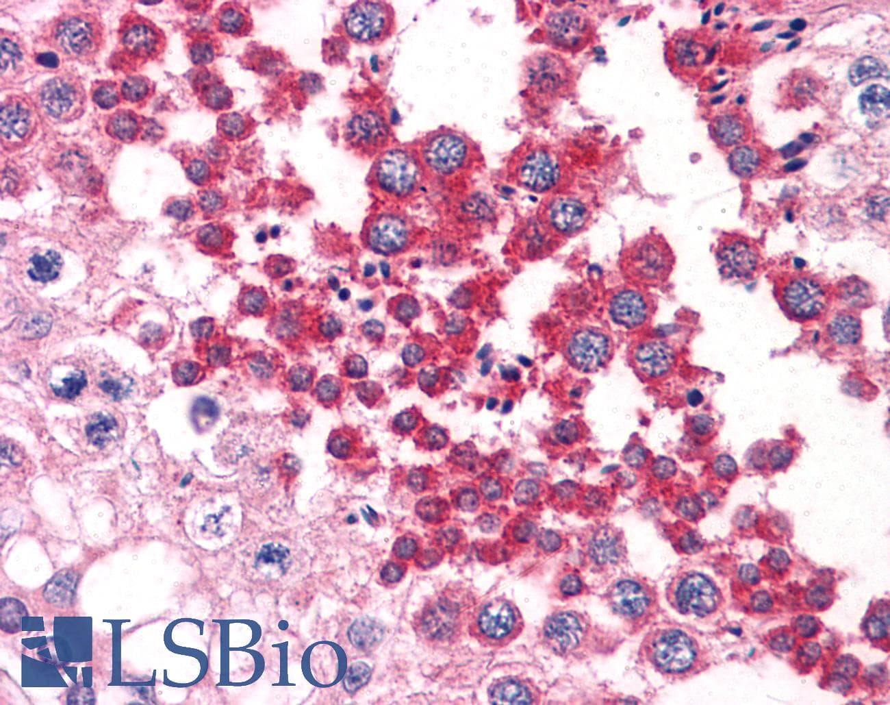 IHC-plus™ SH3GLB1 / Bif / Endophilin B1 Antibody (clone 1B3-A5)