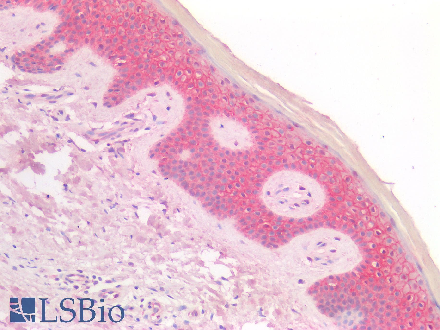 IHC-plus™ Monoclonal Mouse anti-Human CTNNB1 / Beta Catenin Antibody (IHC, WB)