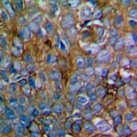 Polyclonal Rabbit anti-Human MEK1 + MEK2 Antibody (Internal, IHC, WB)