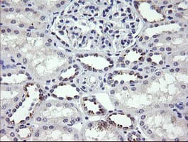 MDM4 / MDMX Antibody (clone OTI2D11)